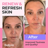 Collagen Peptides Powder for Women Hydrolyzed Collagen Protein Types I and III Non-GMO Grass-Fed Gluten-Free Kosher and Pareve Unflavored Easy to Mix Drink Healthy Hair Skin Joints Nails 5 LB