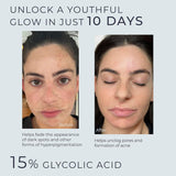 Glycolic Acid Serum for Face 15% Strength - Extra Large Size (2Oz)