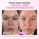 InstaSkincare Glycolic Acid 8% Toner for Face with Hyaluronic Acid 8 Oz